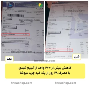 نتایج مشتریان از پک کبدچرب نیوشا