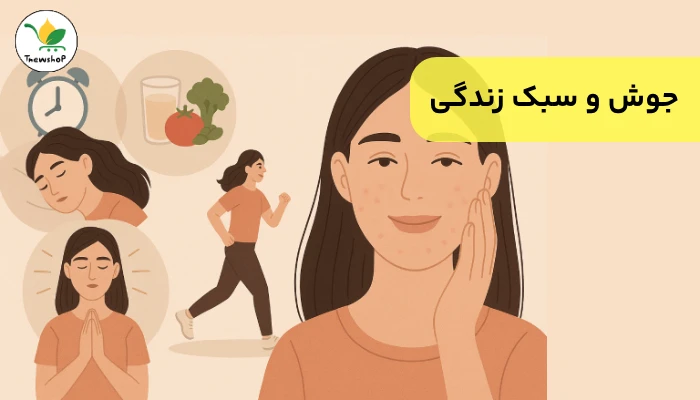 درمان جوش با اصلاح سبک زندگی